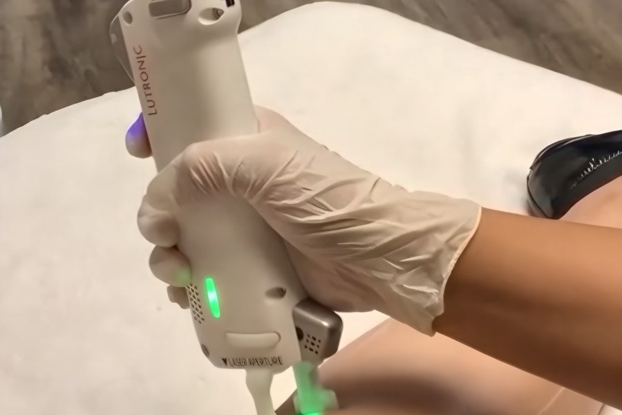Laser hair removal on the underarm